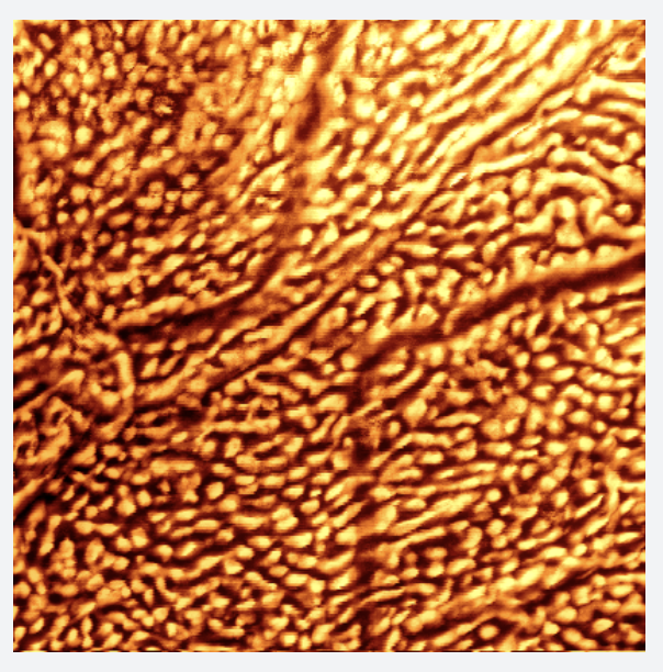 Multicenter Morphometric Analysis of Stratum Corneum Nanotexture for Skin Barrier Assessment