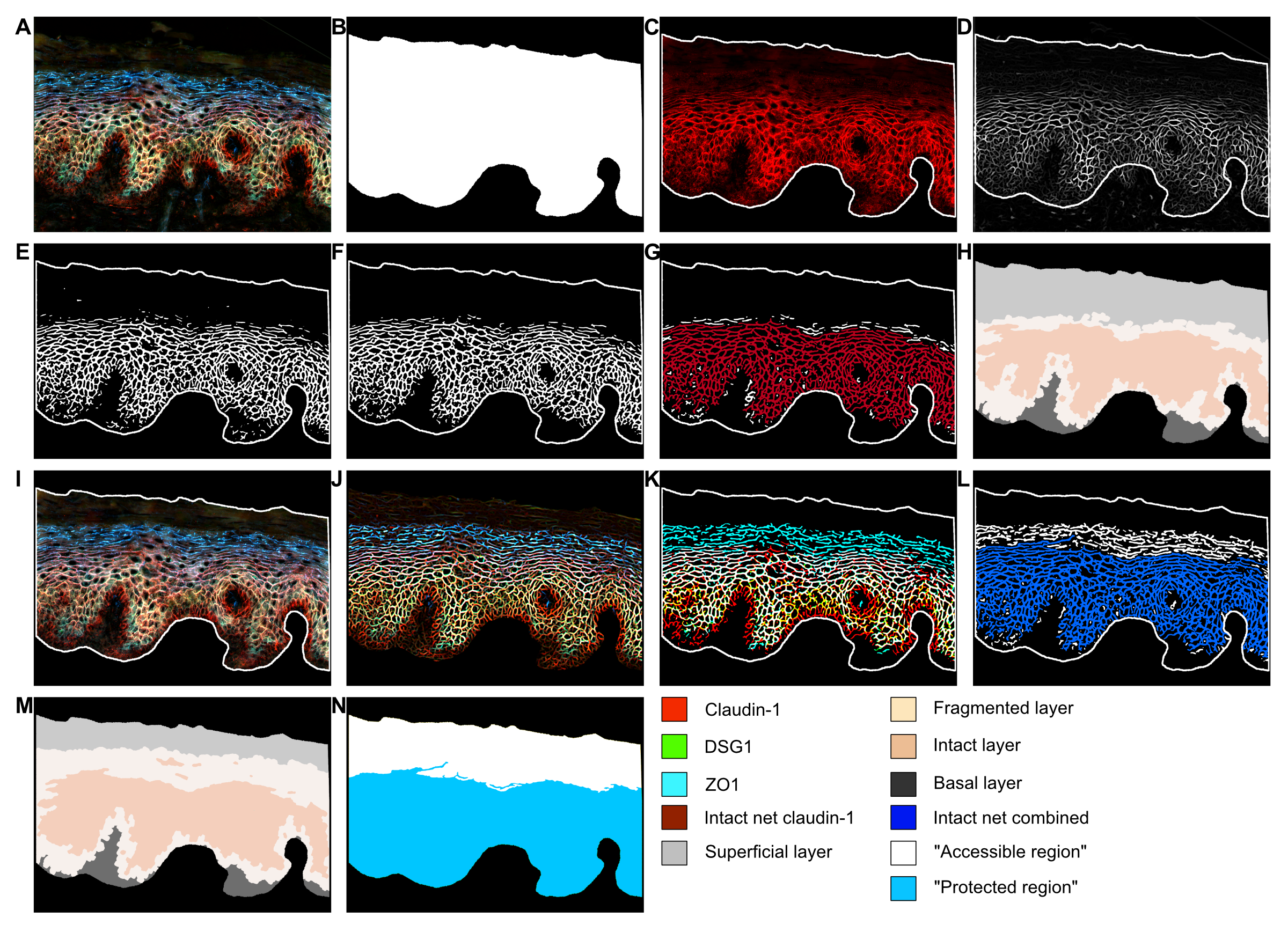 Sustained immune activation and impaired epithelial barrier integrity in the ectocervix of women with chronic HIV infection