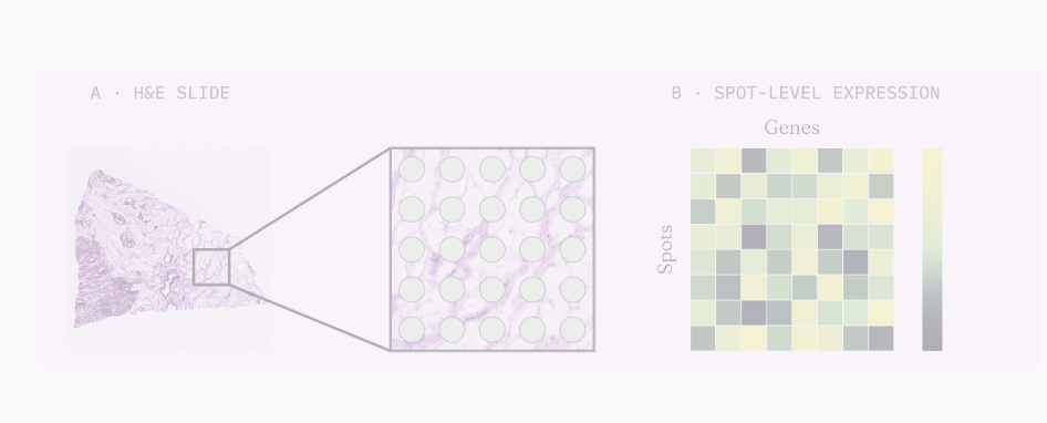 Cross-Modal Generative AI for Spatial Transcriptomics